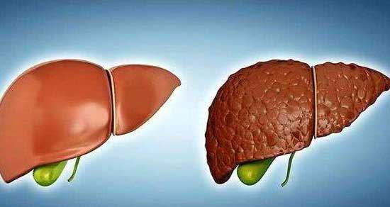 开封哪个医院治肝病好